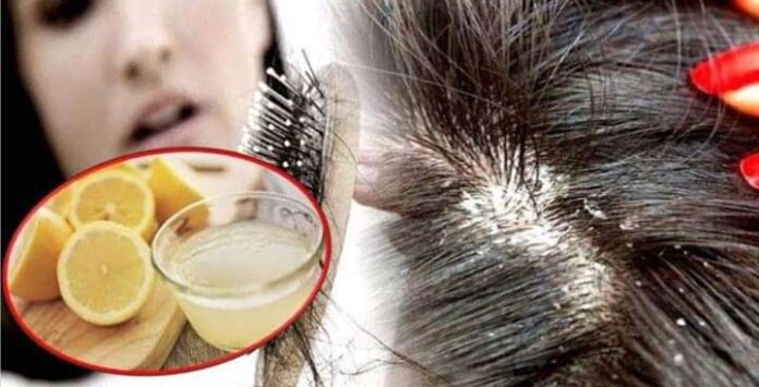 चियापत्ती र कागतीको यसरी गर्नुहोस् प्रयोग, खतम हुनेछ कपालको चायाँ